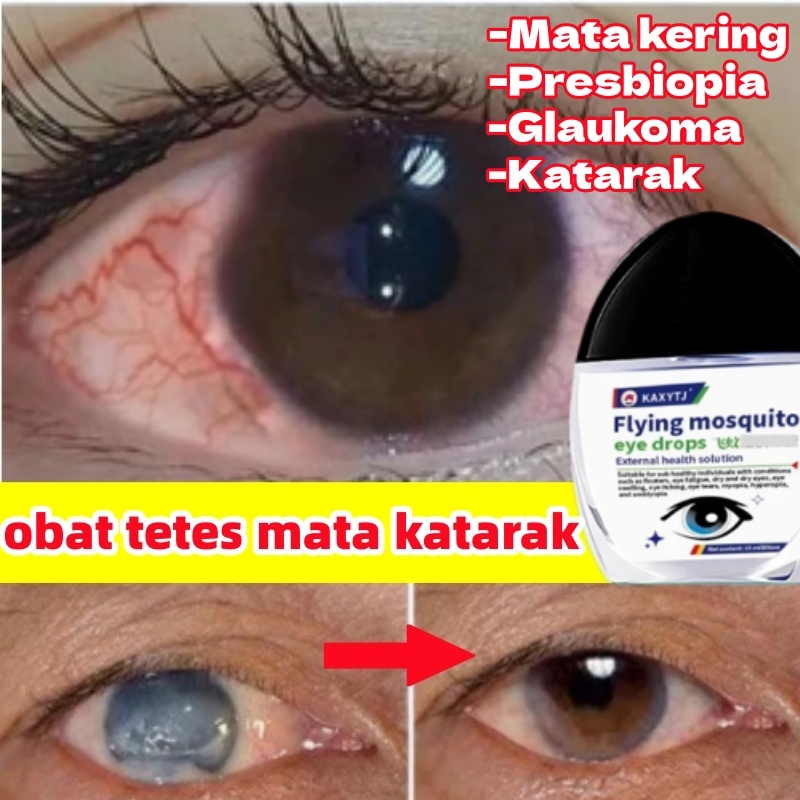 Obat Mata Katarak Obat Tetes Mata Minus Tanpa Mata Kering Mata Perih Mata Tersumbat Mata Kabur Dan B