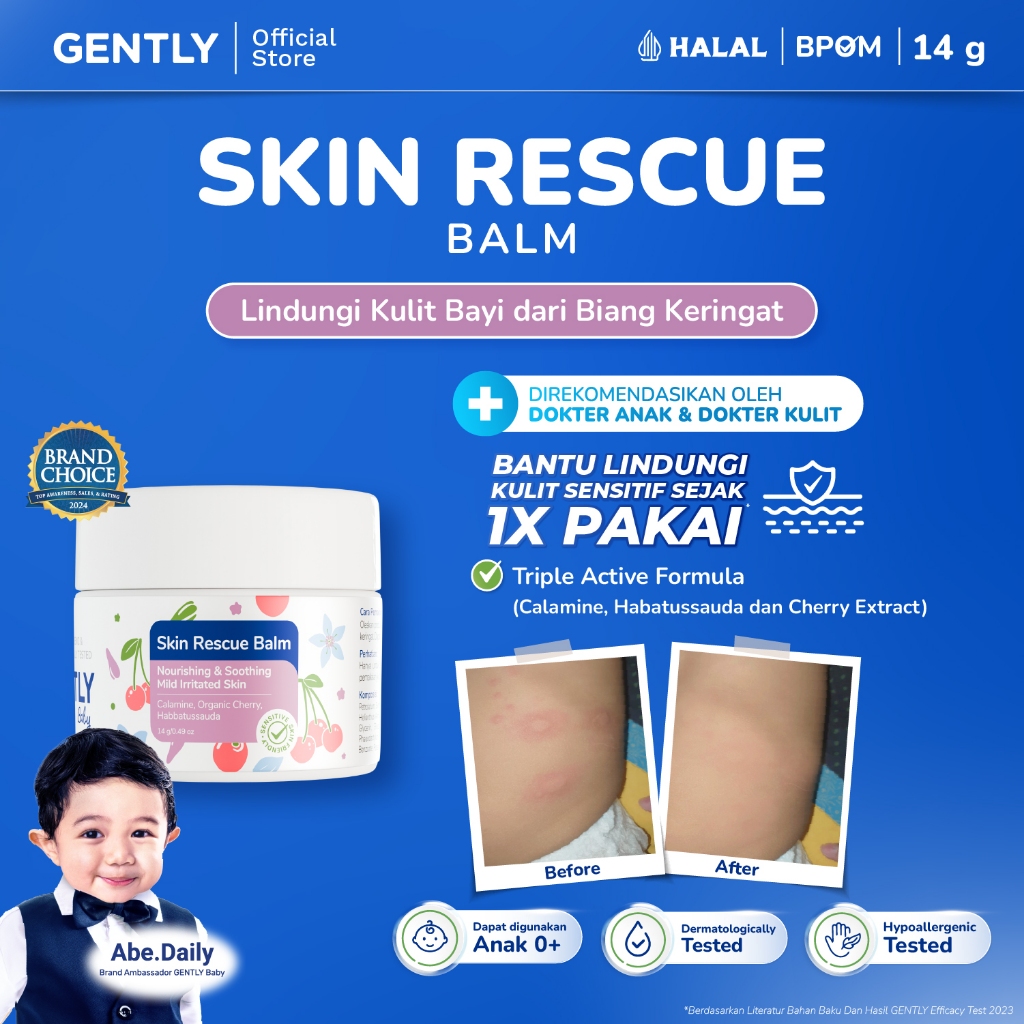 GENTLY Skin Rescue Balm with Calamine, Cherry & Habbatussauda Extract | Baby Moisturizer | Pelembab 