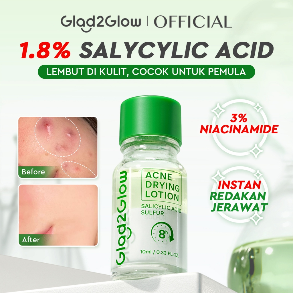 GLAD2GLOW Acne Drying Lotion Mengeringkan Jerawat 8 Jam Dengan Sulfur BHA & Bahan Alami Instant Acne