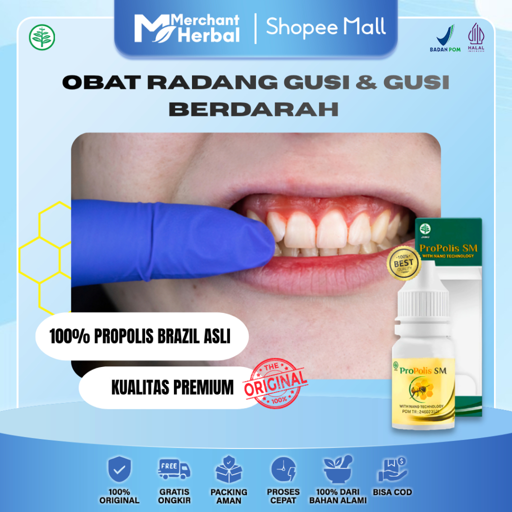 GUSI BERDARAH & RADANG GUSI – Propolis SM Herbal