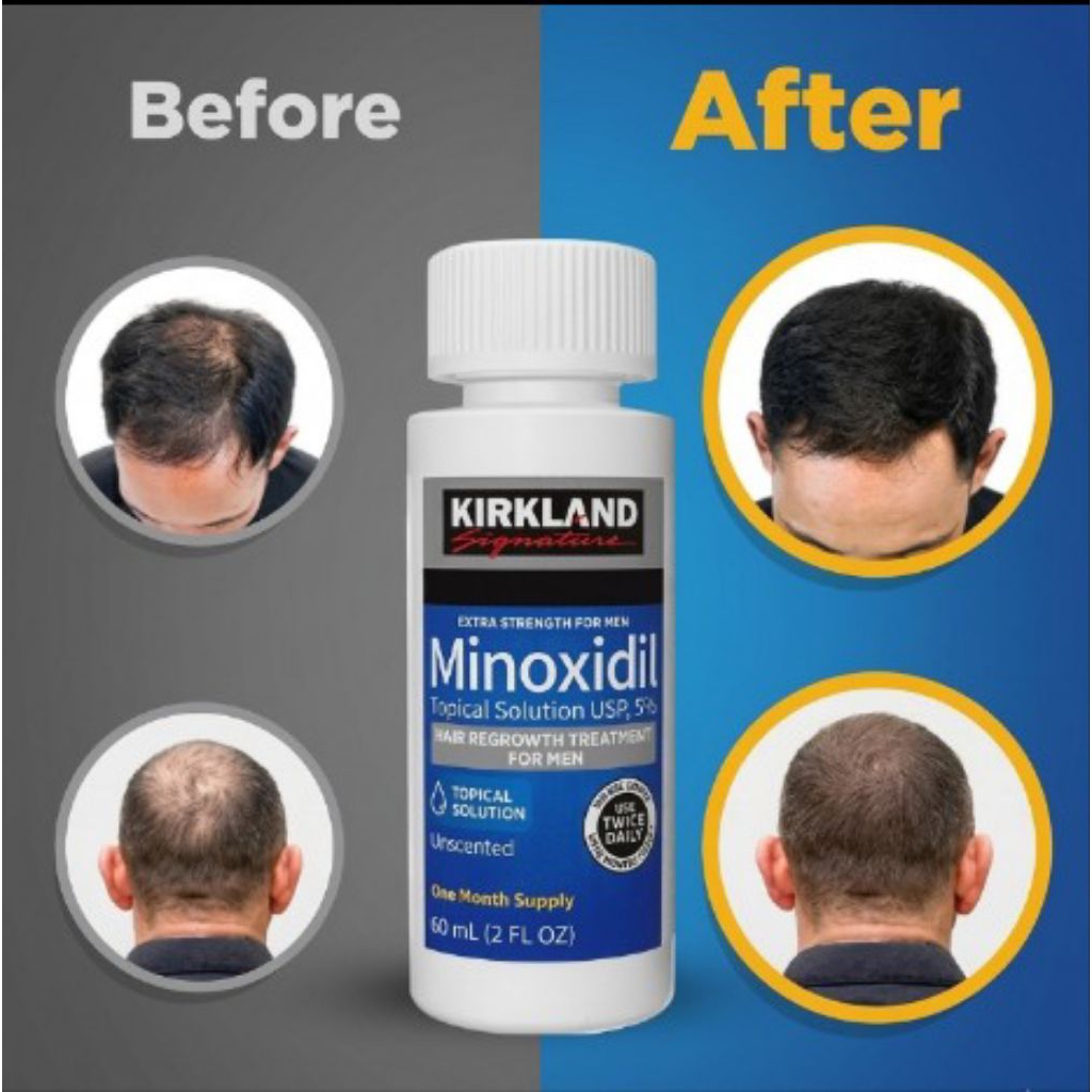 Kirkland Minoxidil 5% Extra Strength 60ml USA