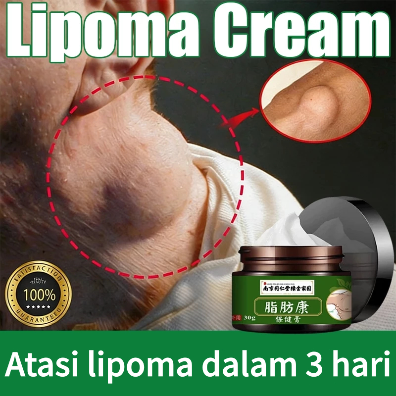 Obat Benjolan Obat kelenjar getah bening Krim Untuk Penghilang Benjolan Kelenjar Getah Bening Lipoma
