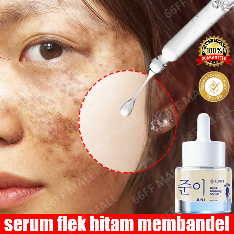 serum flek hitam membandel serum dark spot paling ampuh penghilang flek hitam di wajah serum wajah f