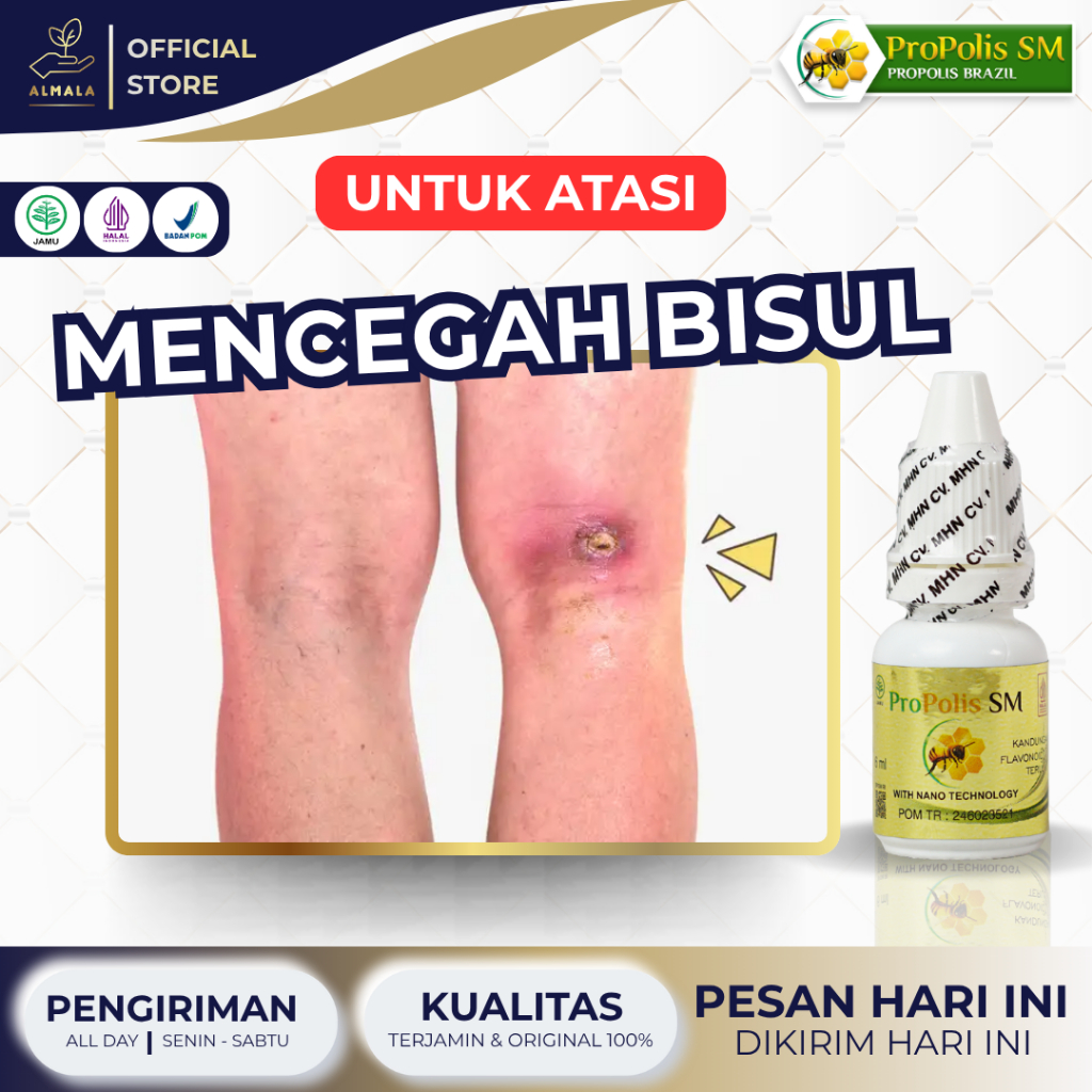 Obat Bisul Agar Gak Tumbuh Lagi, Obat Bisul Agar Cepat Pecah, Bisul Di Pantat, Bisul Di Ketiak, Bisu