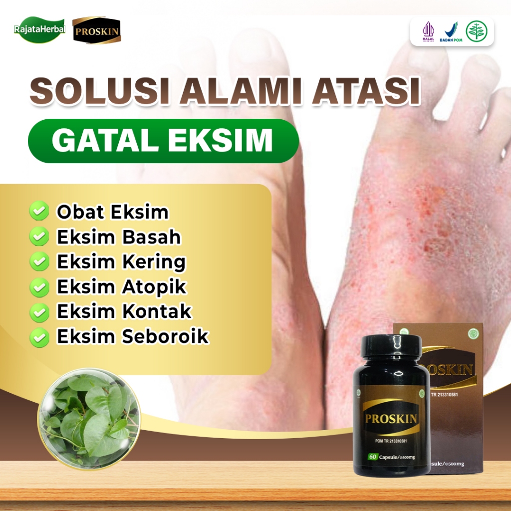 Obat Eksim Basah Eksim Kering Eksim Atopik Seboroik Numularis Dishidrotik Sehat Kulit Proskin Kapsul