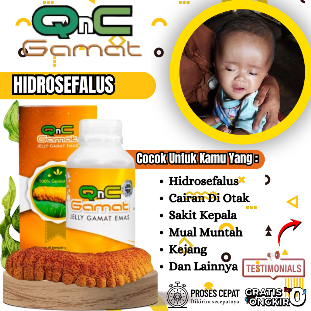 Obat Hidrosefalus Penumpukan Cairan Di Otak Serebrospinal Sakit Kepala Mual Muntah Kejang Penurunan 