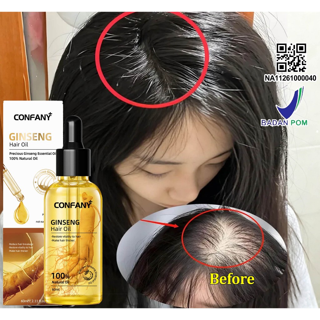 BPOM Ginseng serum penumbuh rambut Serum rambut rontok Hair tonic Hair Growth Serum Serum Anti Ronto