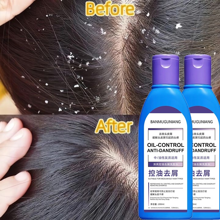 Selenium Disulfide Shampoo Oil Control sampo anti ketombe Anti-Dandruff Anti-Itch Anti Hairfall Pera