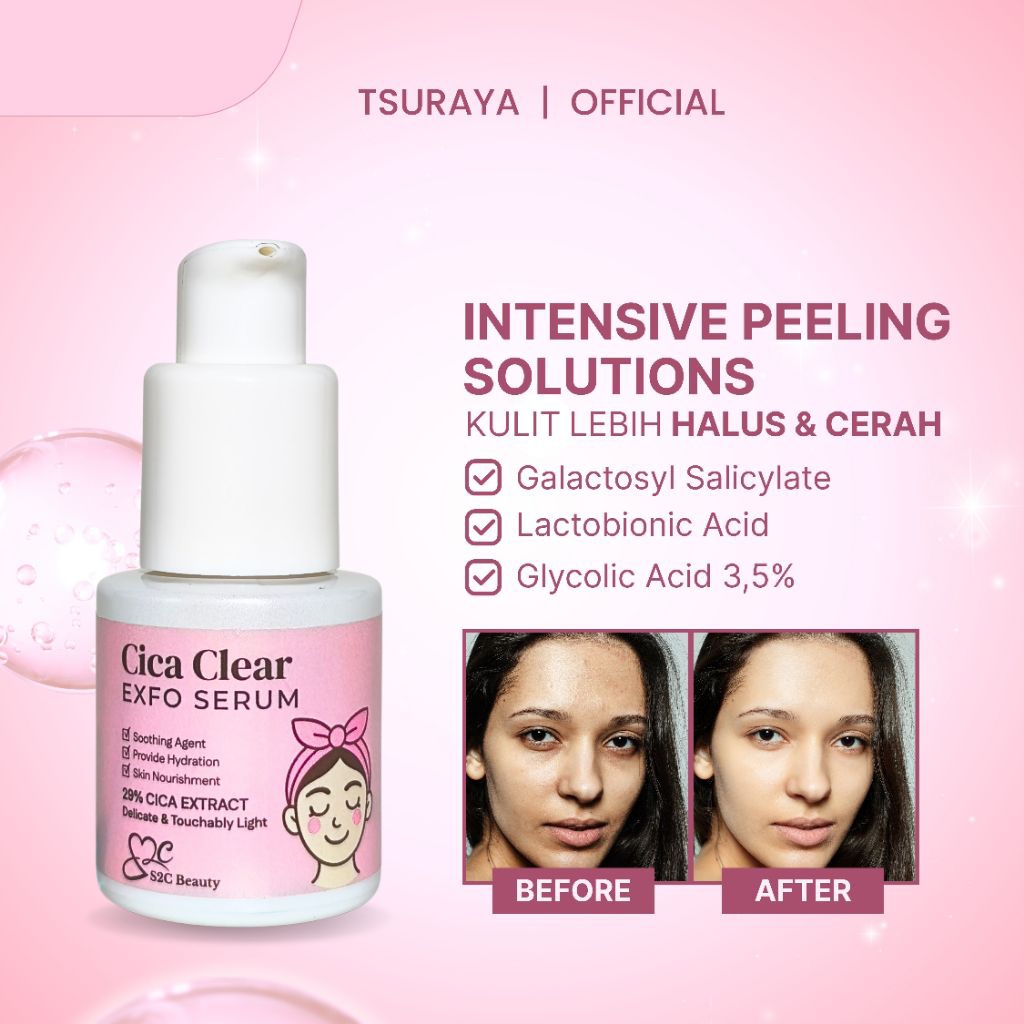 Cica Clear Exfo Serum - Serum Eksfoliasi Wajah Angkat Sel Kulit Mati, Bruntusan & Jerawat | Tsuraya