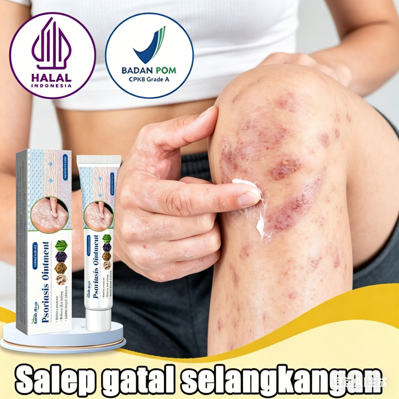 salep gatal paling ampuh salep gatal obat gatal selangkangan obat selangkangan gatal dan hitam obat 