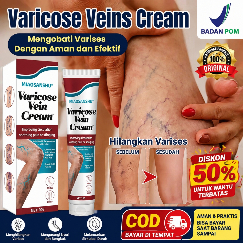 [BPOM] Salep Varises Original - Obat Penghilang Urat Menonjol & Kaki Bengkak - Krim Vaskulitis Herba