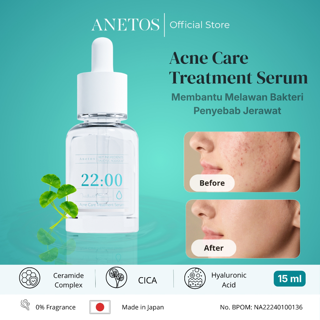 Anetos Acne Care Treatment Serum – 15ml (Serum Wajah, Essence, Membantu Mengatasi Kulit Berjerawat)