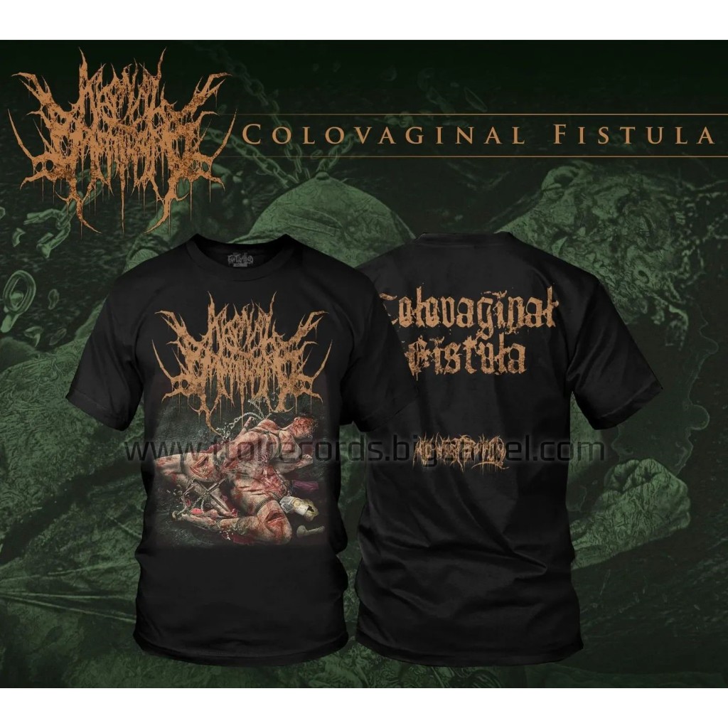 ORIGINAL TSHIRT AGONAL BREATHING - COLOVAGINAL FISTULA