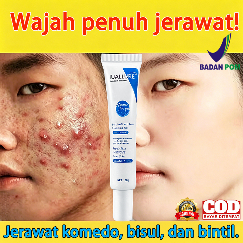 IUALLURE Gel Essence 20g Niacinamide Redakan Jerawat Bersihkan Noda Kecilkan Pori Mencerahkan Wajah 