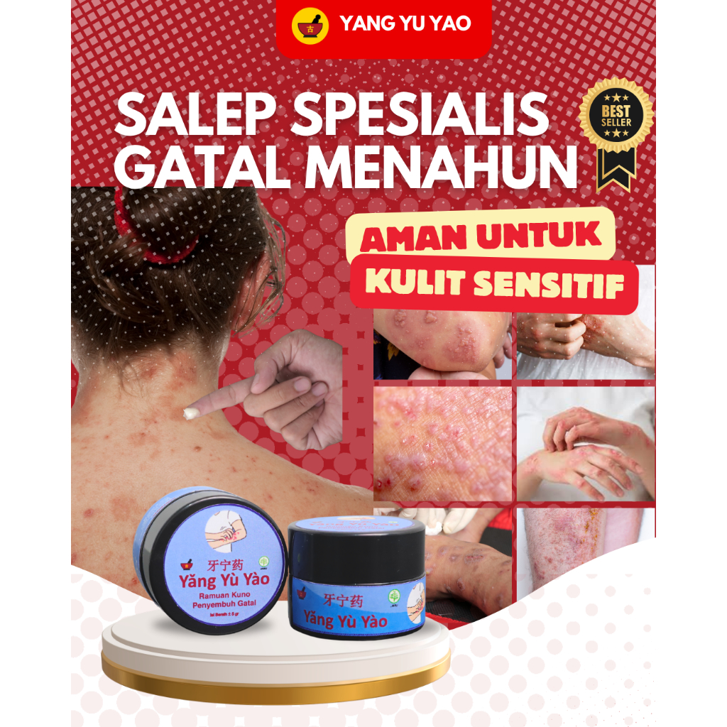 Salep Gatal Menahun Yang Yu Yao Obat Gatal Cina Ampuh