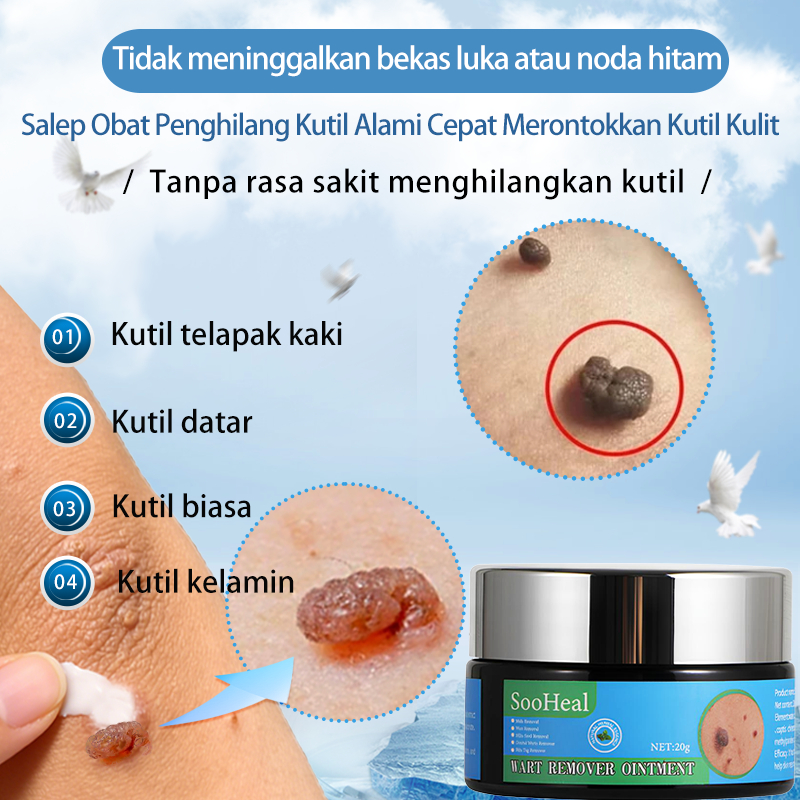 salep kutil,Obat Penghilang Kutil,20g,Ampuh menghilangkan kutil secara permanen,Hilangkan Kutil Tunt