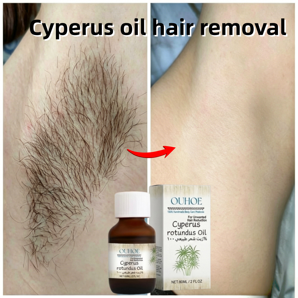Minyak cyperus original pembersih ketiak hitam dan bulu perontok bulu ketiak penghilang bulu kaki me