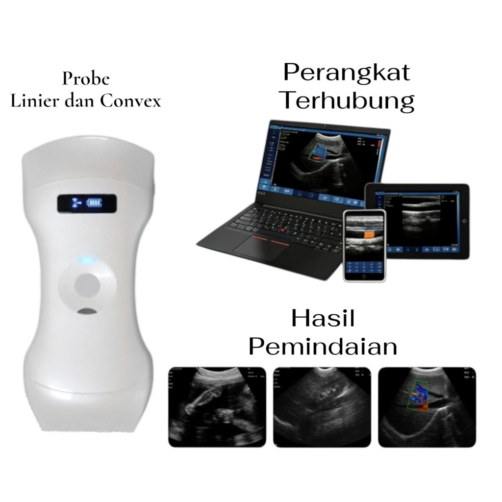 USG / Ultrasonografi Genggam Portabel 2 in 1 Nirkabel – Probe Convex & Linier | Koneksi WiFi Bisa Hu