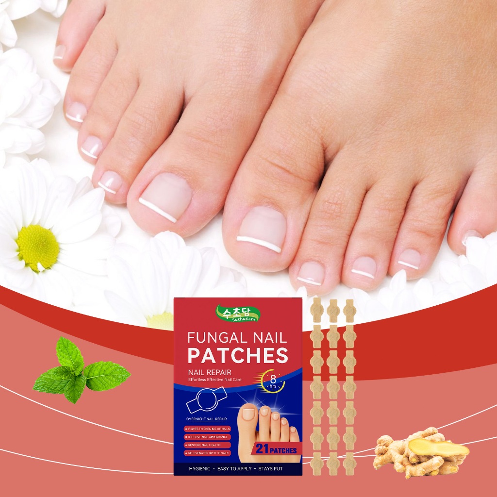 Suchodam Fungal Nail Patch 21 Pcs Perawatan Kuku Anti Jamur Melembut & Mencerahkan Kuku Tebal Rusak 