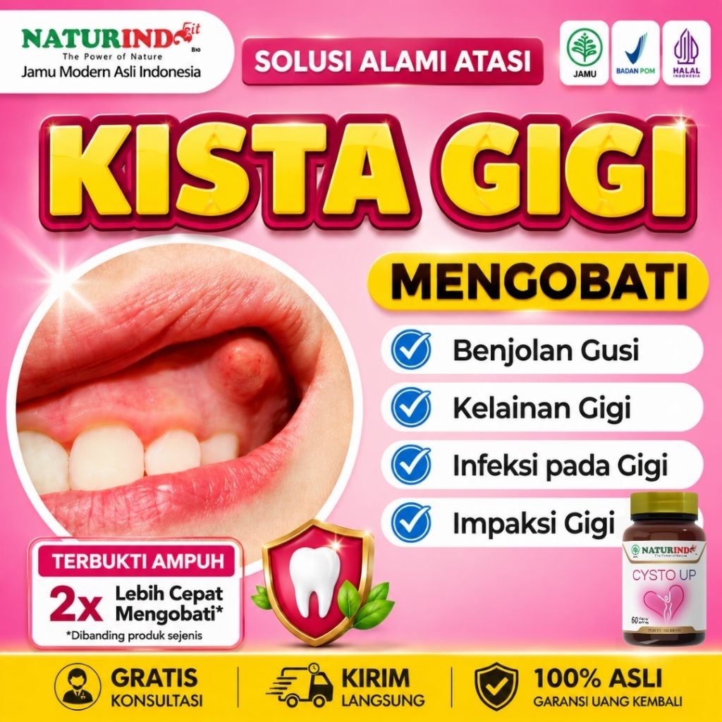Obat Kista Gigi Tumor Gigi Benjolan Gusi Kelainan Gigi Herbal Ampuh