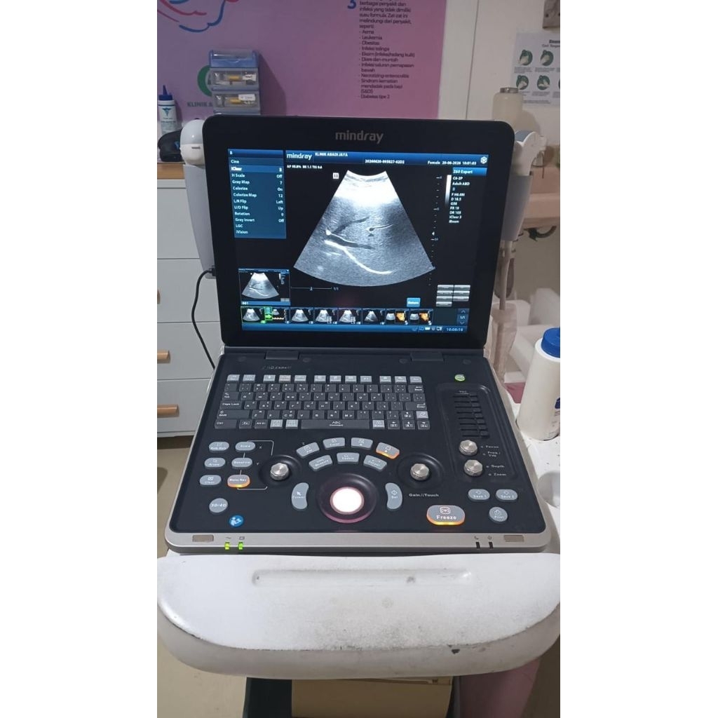 Usg 4D Mindray Z60 expert second