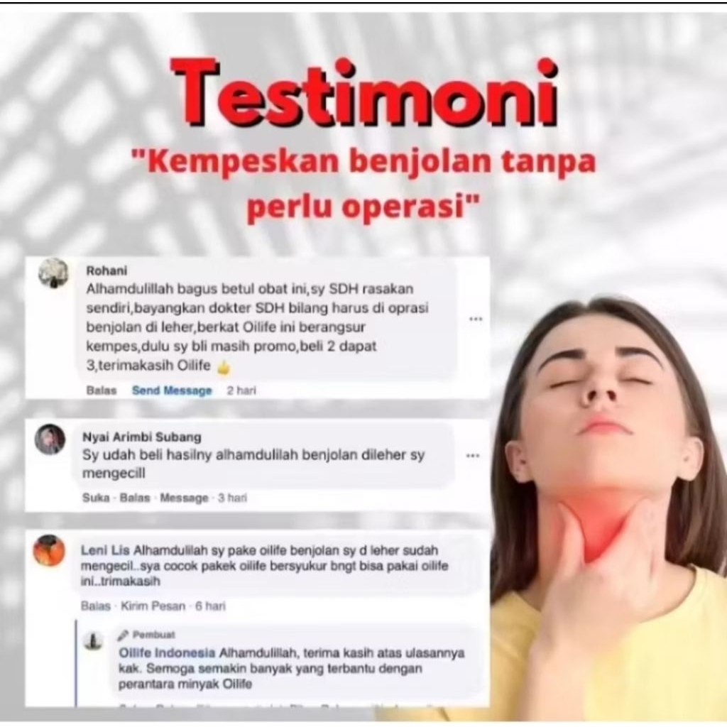 Minyak oles yang Mengatasi berbagai Benjolan (Oilife) Herbal alami