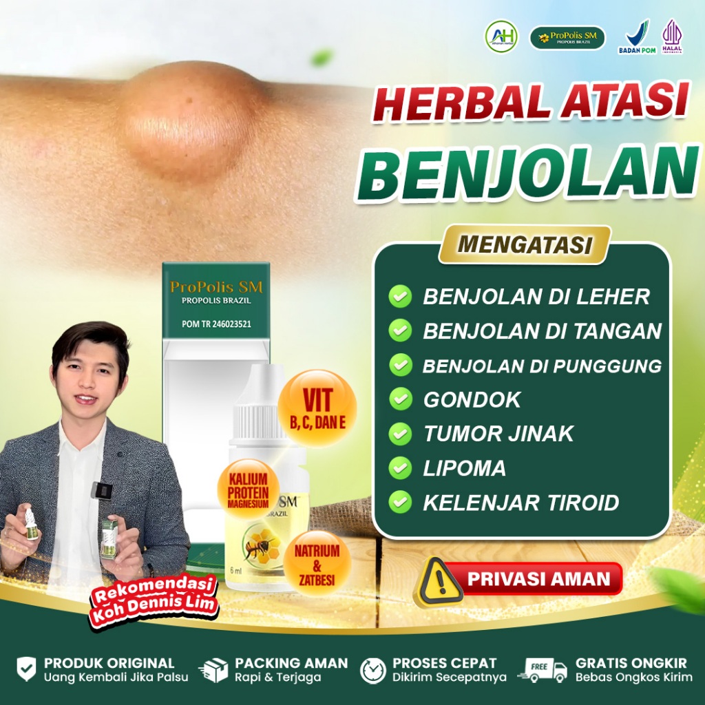 Obat Kelenjar Getah Bening Benjolan di Leher Ketiak Selangkangan Belakang Telinga - Propolis SM Asli