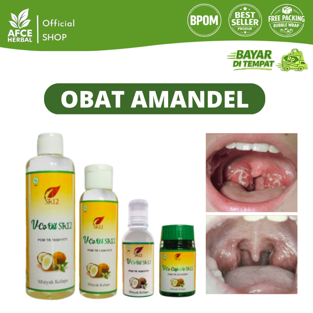 OBAT AMANDEL / OBAT AMANDEL ANAK / OBAT AMANDEL DEWASA AMAN BPOM AMAN UNTUK ANAK