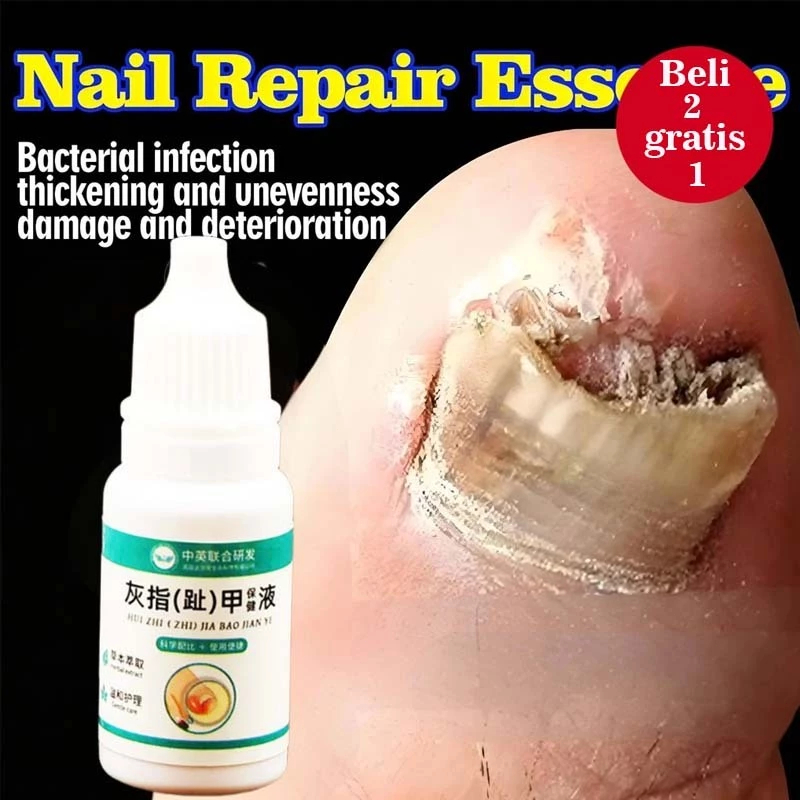 Obat Jamur Kuku 10ml Nail Repair Essence Serum Antibakteri Perawatan Kuku Rusak dan Jamur Onikomikos