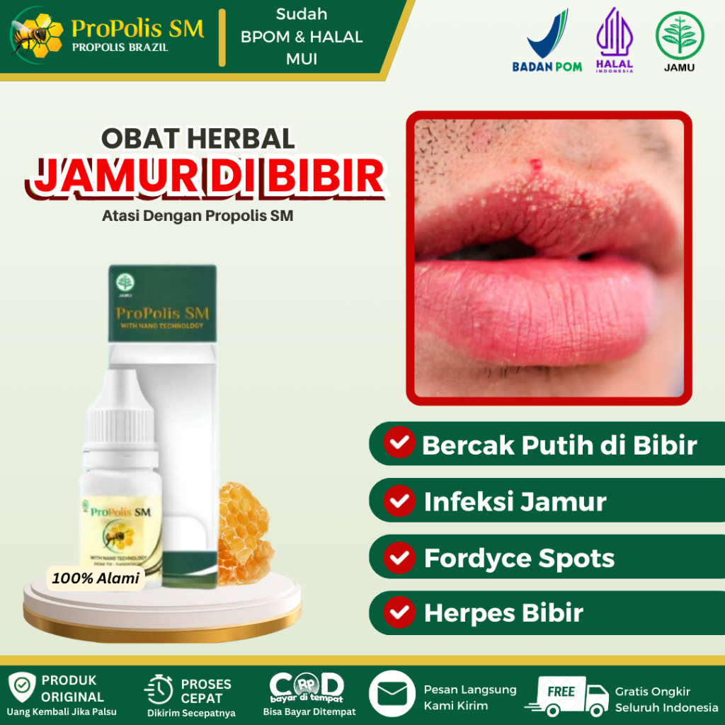 Propolis SM - Obat Bintik Putih Di Bibir, Bercak Putih di Sekitar Bibir, Infeksi Jamur Pada Bibir, F