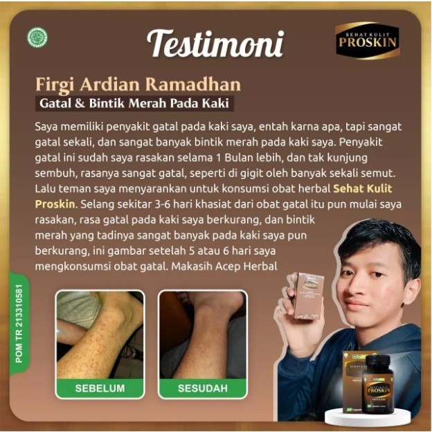 Proskin Obat Gatal Kulit Herbal BPOM Halal