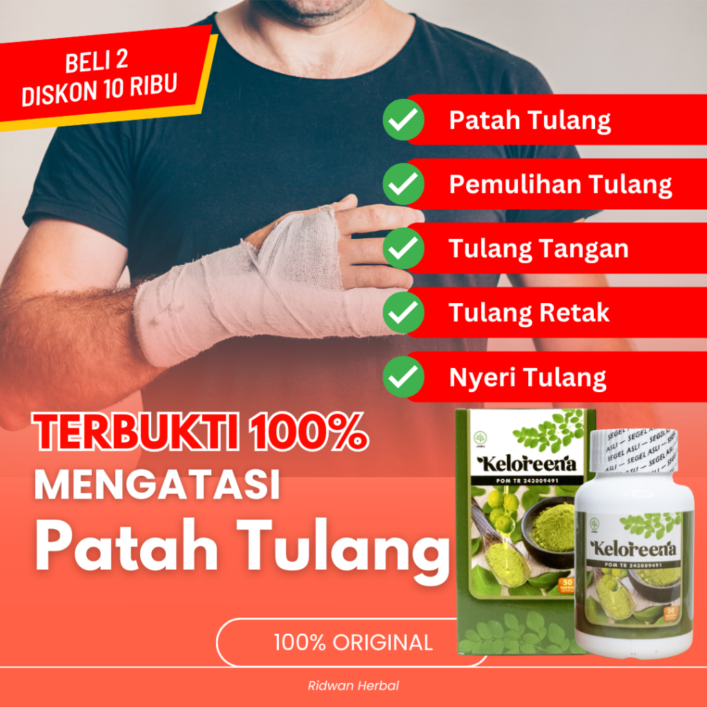 Obat Patah Tulang, Pemulihan Patah Tulang, Patah Tulang Kaki, Patah Tulang Tangan, Penyambung Patah 