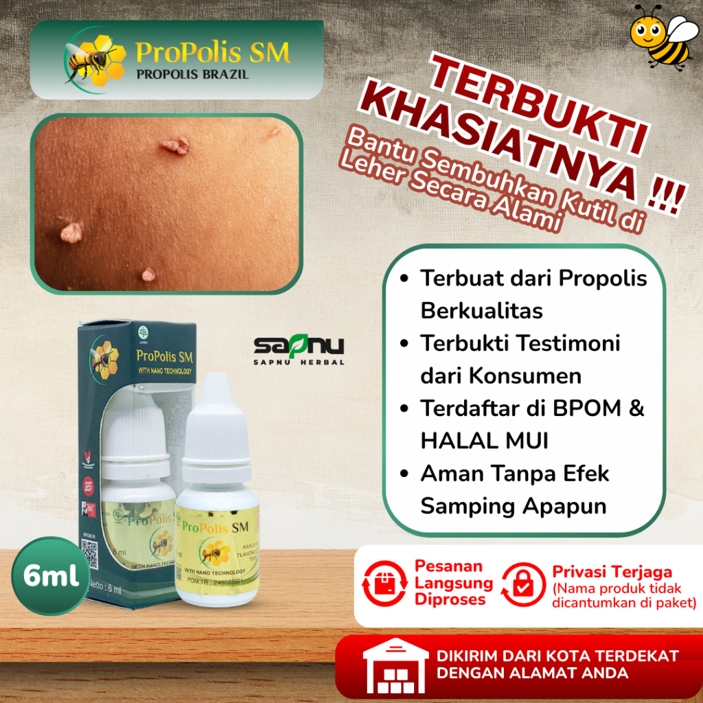 Obat Oles Perontok Kutil Di Leher, Obat Kutil Di Leher, Obat Penghilang Kutil, Obat Daging Tumbuh, O