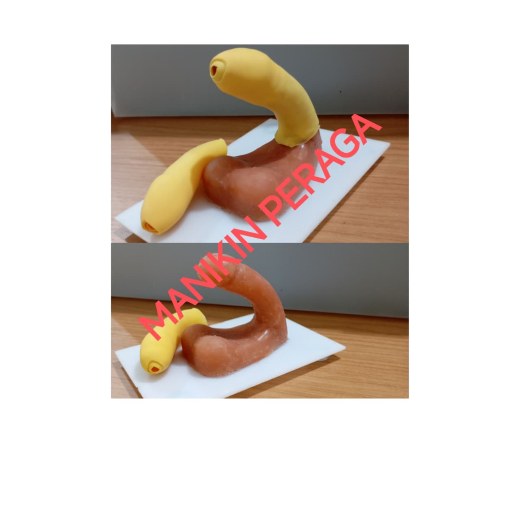 Kulit Sirkumsisi 2 lapis. Manikin Sirkumsisi dengan kulit sirkumsisi 2 Lapis