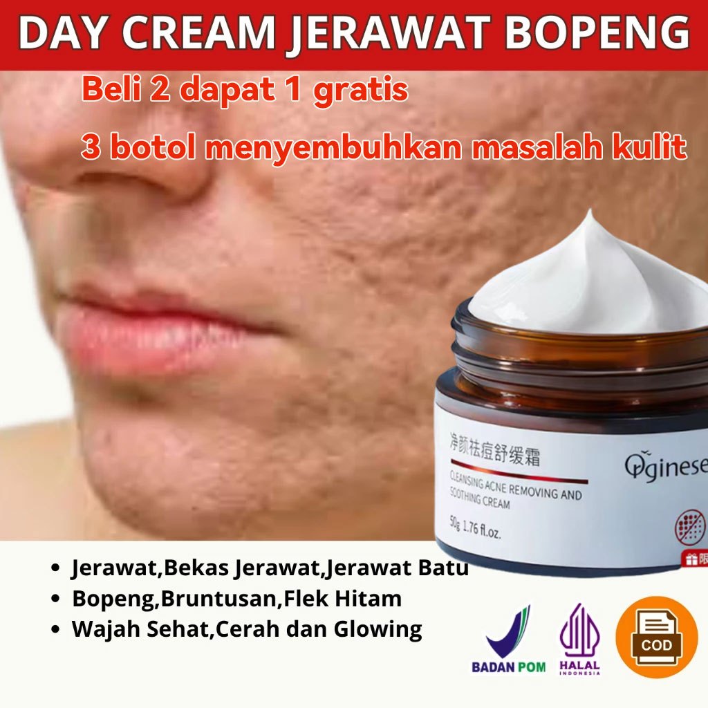 Krim Penghilang Jerawat Cream Penghilang Jerawat Dan Flek Hitam Cream Pencerah Wajah BPOM removal of