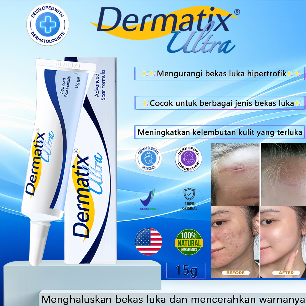 [100% Impor Asli][COD]Dermatix Salep Penghilang Bekas Luka/Dermatix Ultra Advanced Scar Gel Penghila