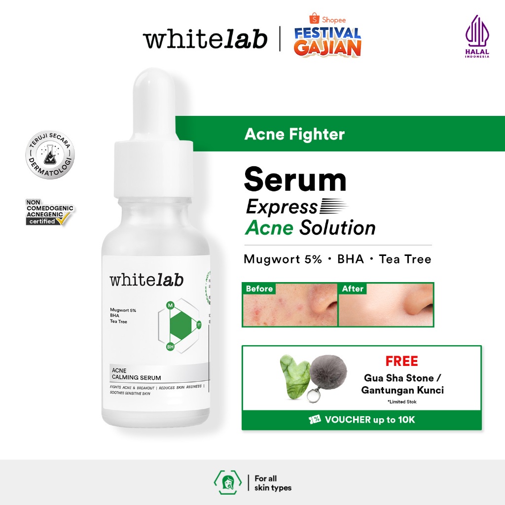Whitelab Acne Calming Serum - Serum untuk Kulit Jerawat, Bruntusan, dan Berminyak dengan Mugwort, BH