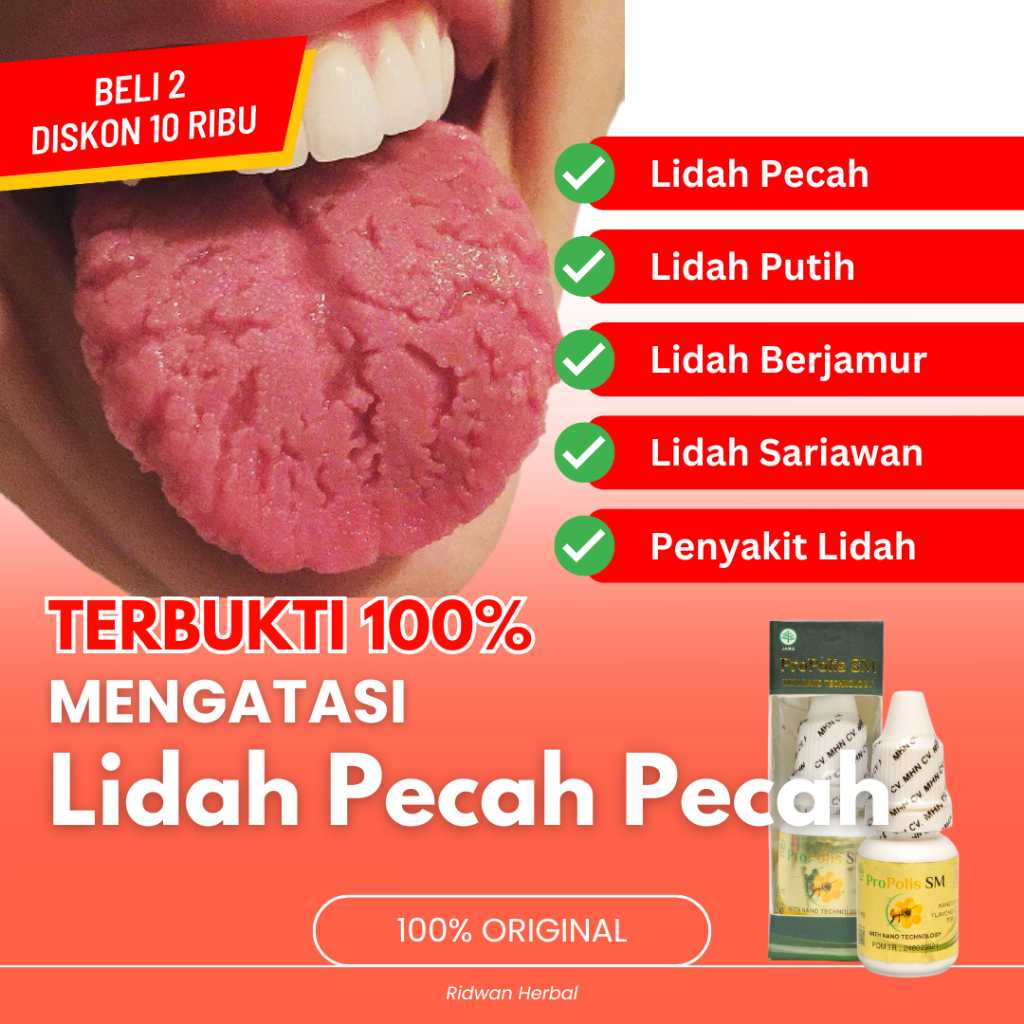 Obat Lidah Pecah Pecah Lidah Putih Berjamur Lidah Mati Rasa Lidah Terasa Pahit Lidah Sariawan Lidah 