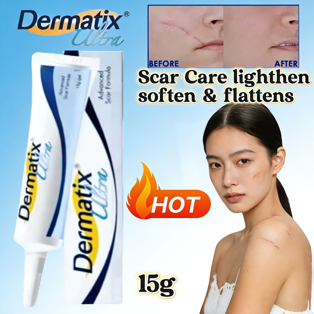 *ORI EXP2028 Beli 2 gratis 1* - Dermatix Ultra Scar Removal Cream 15gr Penghilang Bekas Luka - Stret