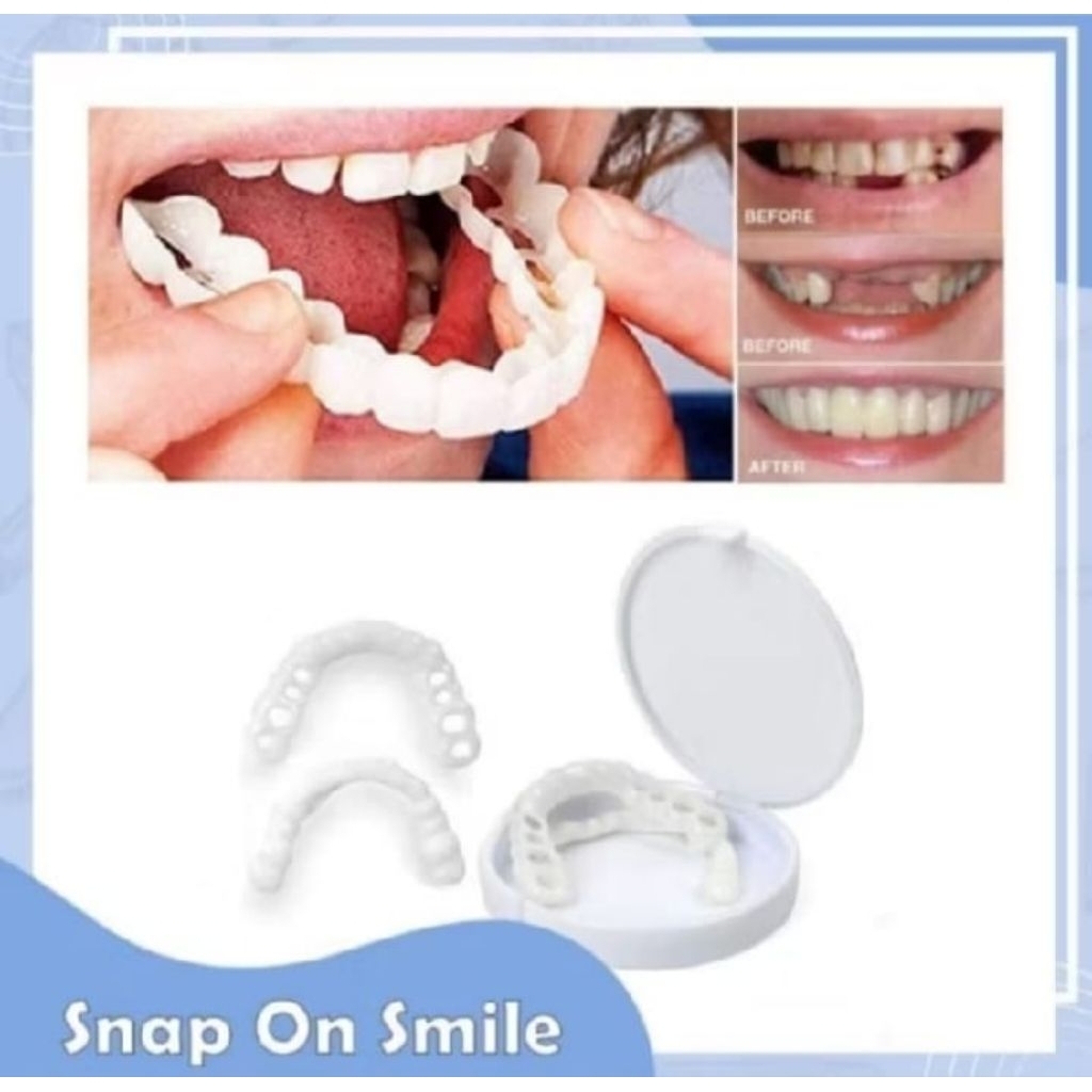 Snap On Smile Veneer Instan Gigi Palsu Tiruan Kesehatan Mulut