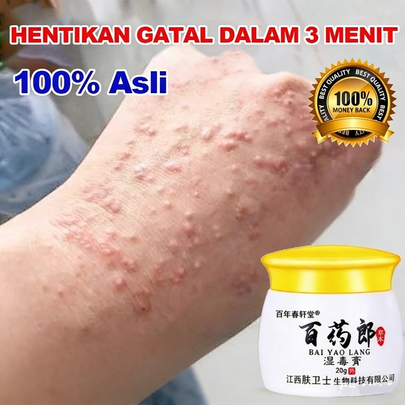 Salep Eksim Kering dan Gatal Salep Gatal China Paling Ampuh Obat Gatal Selangkangan Salep Bayi Untuk