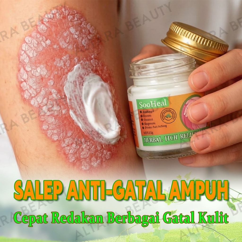 Salap gatal China Salap gatal kulit yang ampuh Salap kurap paling ampuh 15g Salep selangkangan eksim