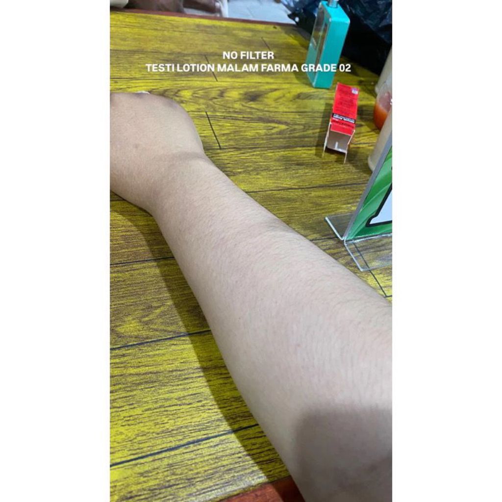 LOTION GRADE A2 FARMA SKINCARE MEMUTIHKAN DAN MEMUDARKAN BEKAS LUKA