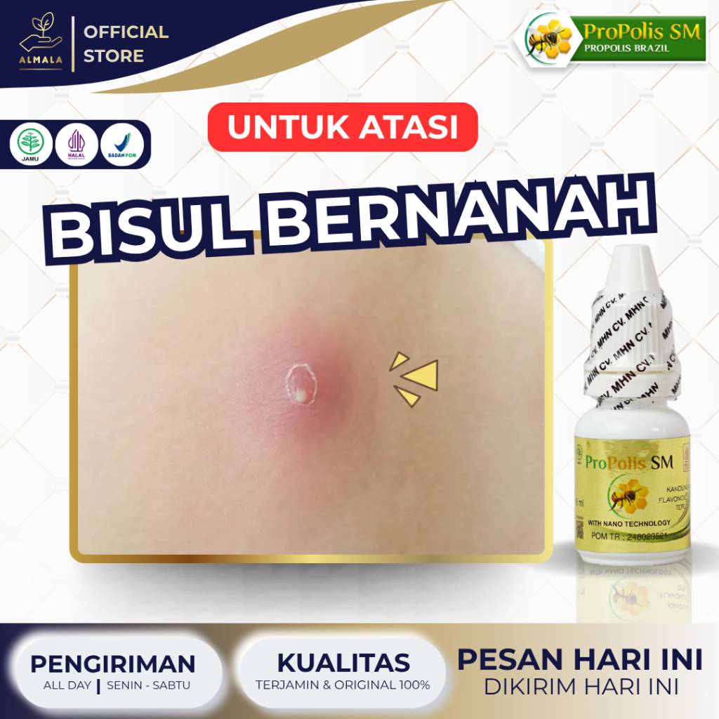 Obat Bisul Bernanah Bisul Bengkak Bisul Berdarah Bisulan di Ketiak Bisul di Pantat  Propolis SM 6 ML