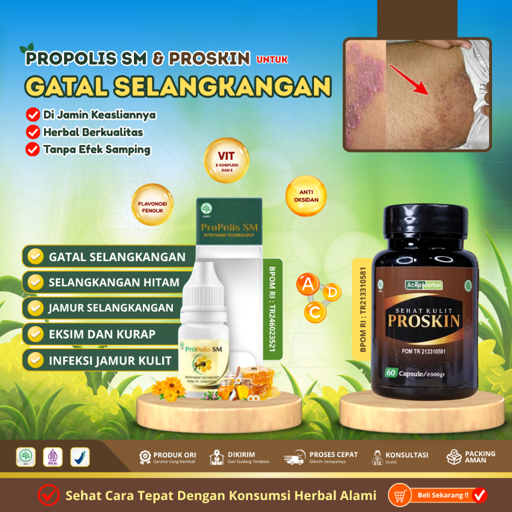 Obat Gatal Selangkangan, Penghilang Selangkangan gatal dan lecet, Obat Pantat Burik - Obat Pantat Ga