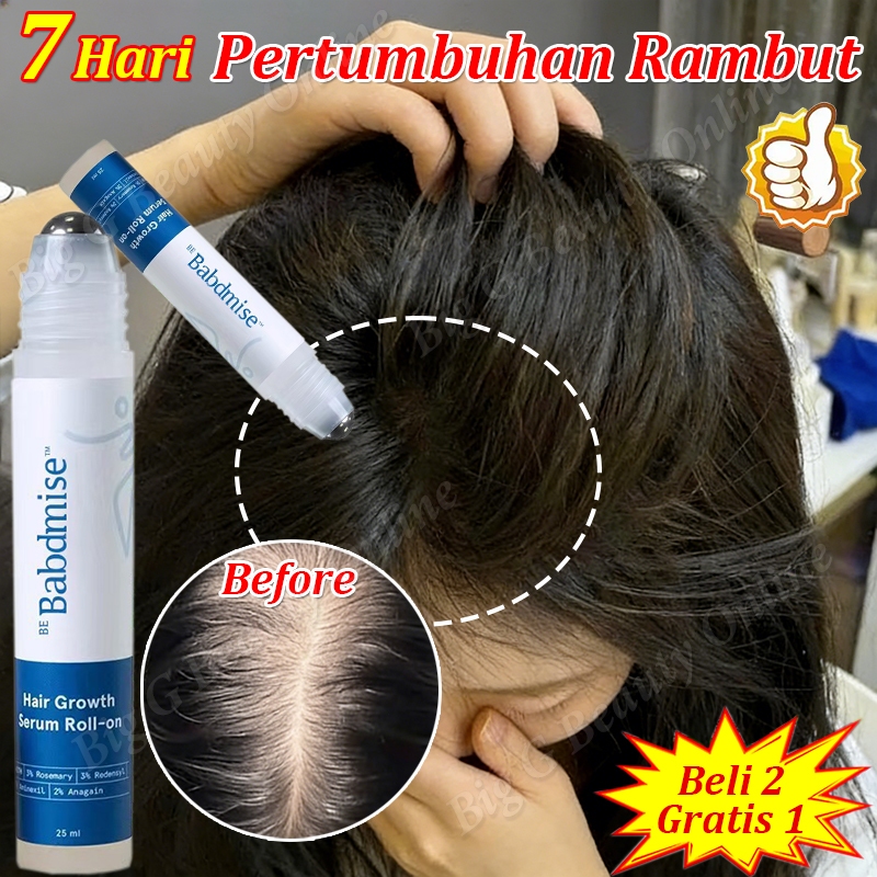 Rosemary Oil Rambut Roller Penumbuh Rambut Botak Hair Growth Serum Rambut Rontok Dan Penumbuh Rambut
