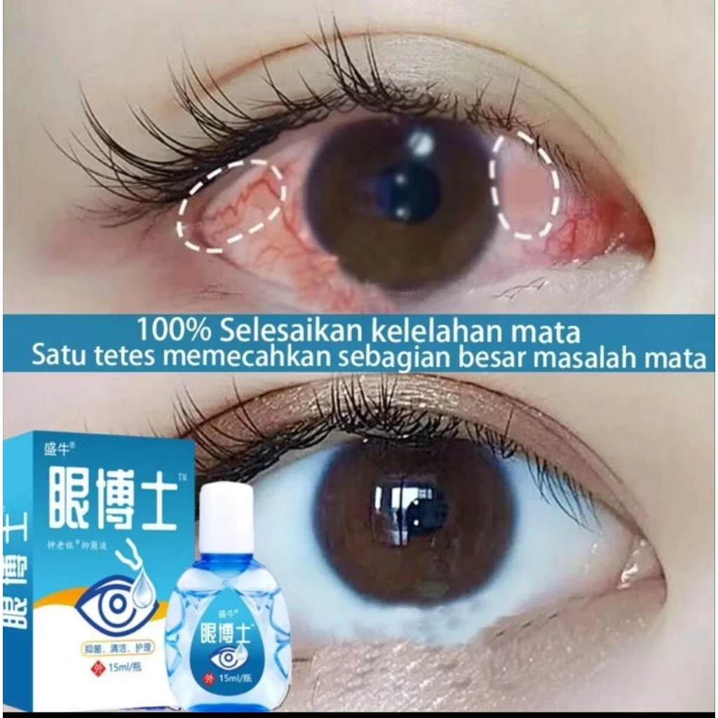 Obat Tetes Mata Katarak Tetes Mata Minus Paling Ampuh Obat Mata Darah Merah Ketegangan Mata