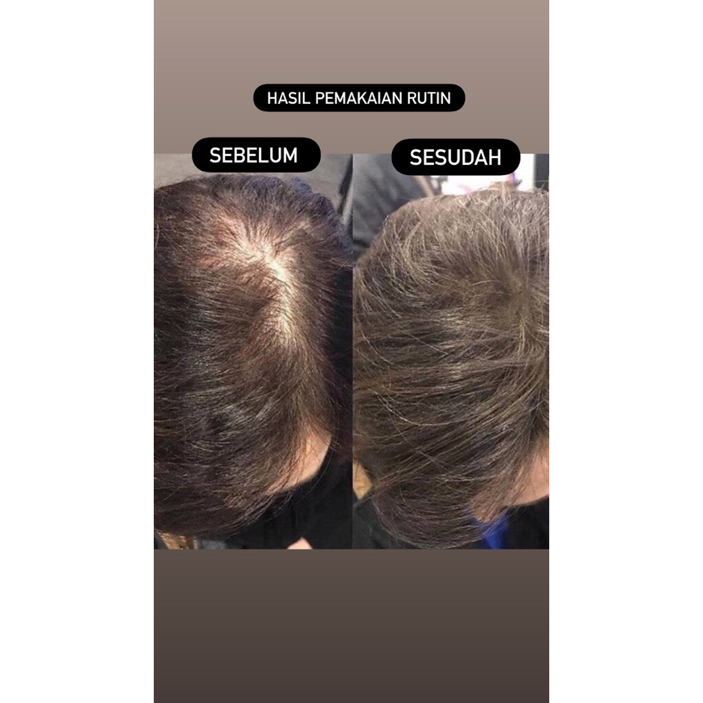 minyak kemiri murni 100%