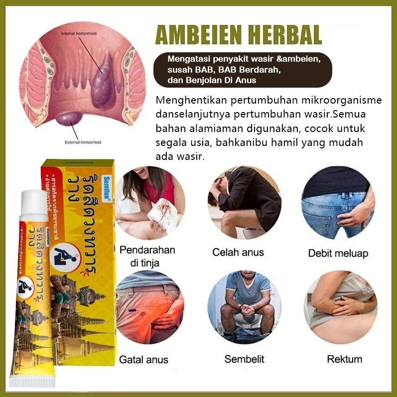 Thailand Obat wasir Salep wasir Salep ambeien paling ampuh 20g Ekstrak herbal untuk menghilangkan am