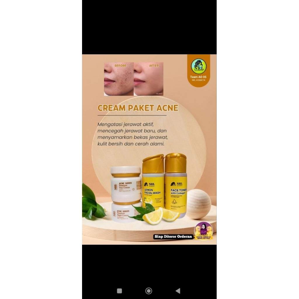 cream NRL ekonomis varian acne